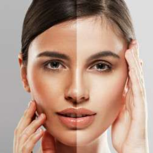 روشن کننده پوست