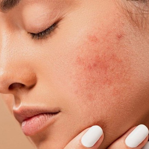 ترمیم کننده پوست